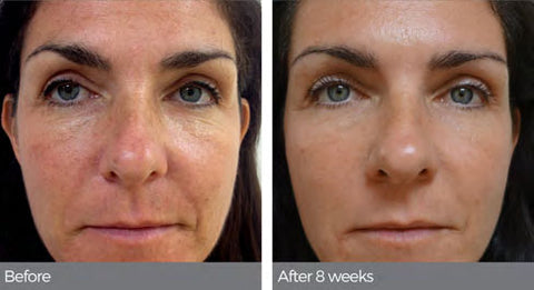 C-Stem Concentrated Anti-Aging Serum 15ml