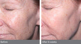 Advanced Retinol Wrinkle and Skin Tone Corrector