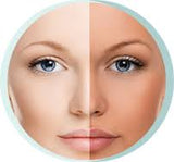 Skin Brightening System includes Vita Soothe Replenishing serum,Vita-C 20 Brightening Cream and Salicylic micro-exfoliating Cleanser